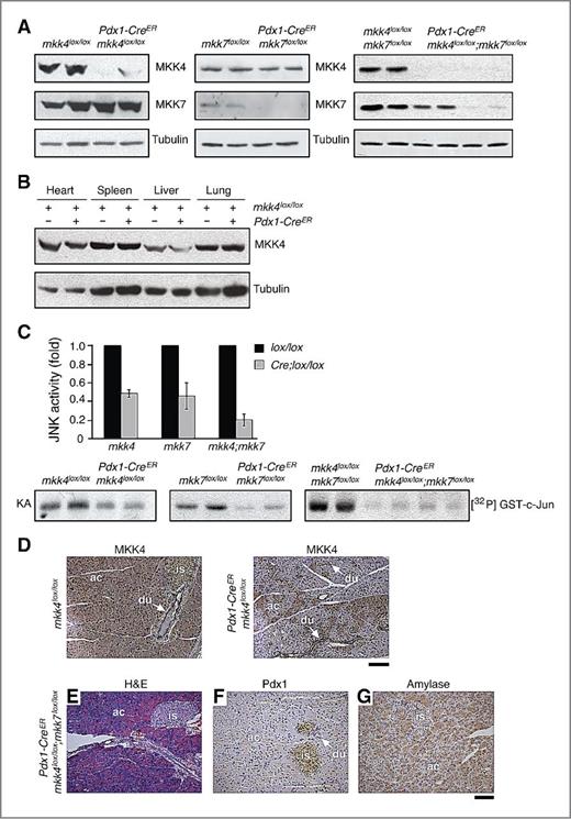 Figure 1. MKK4 and MKK7 are not required for pancreatic homeostasis. A and B, immunoblot analyses of MKK4 and MKK7 expression in organs derived from 6 weeks old mkk4lox/lox, mkk7lox/lox, and compound mkk4lox/lox;mkk7lox/lox mice carrying or not carrying the Pdx1-CreER transgene and exposed to tamoxifen at 7 days after birth. The images represent distinct animals for each genotype. C, endogenous JNK activity in pancreatic extracts was measured by protein kinase assay (KA). Radioactivity incorporated in GST-cJun was quantified by phosphoImager. The data correspond to the mean ± SD (N = 2). The autoradiography represents distinct animals for each genotype. D, MKK4 immunostaining of pancreata extracted from 6 weeks old animals reveals that Cre-mediated recombination of the mutant allele occurs in a mosaic fashion. E–G, compound deletion of mkk4 and mkk7 does not disrupt the architecture of the pancreas in 6 weeks old mice as determined by hematoxylin and eosin staining (E), Pdx1 immunostaining of islets (F), and amylase immunostaining of acinar cells (G). ac, acinar cells; du, ducts; is, islets. Scale bars, 200 μm.