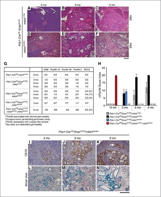 Figure 2. MKK4 deficiency accelerates KrasG12D-induced mPanIN progression. A–F, hematoxylin and eosin (H&E) staining of pancreata derived from mice exposed to tamoxifen. Expression of KrasG12D alone induces ADM and the formation of low-grade mPanIN lesions that increase with severity as mice age (compare B and C). The simultaneous deletion of mkk4 greatly accelerates mPanIN formation as evident within 3 months of age (D). By 6 months of age, all mice had developed adenocarcinoma (E and F). G, table indicating the number of mice per genotype presenting with specific pancreatic pathology. H, mPanIN score index in pancreata of mice exposed to tamoxifen were calculated as described in Materials and Methods. A score of 0 indicates normal pancreas pathology whereas 20 indicates that all mice present with PDAC. The data correspond to the mean ± SD. ND, not determined. I–N, mPanIN lesions and adenocarcinoma observed in pancreata of Pdx1-CreER;KrasG12D;mkk4lox/lox mice exposed to tamoxifen display a ductal phenotype as determined by immunohistochemical analysis for CK19 expression (I–K) and mucin production (L–N). Arrow, CK19-expressing epithelial tumor cells invading into the stromal region. Scale bar, 200 μm.