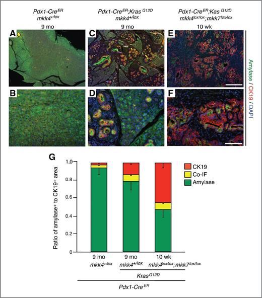 Figure 5. The loss of mkk4 and mkk7 accelerates the appearance of CK19-positive neoplastic ductal structures. A–F, immunofluorescence staining for amylase positive acinar cells (green) and ductal expressing CK19 cells (red). Normal pancreata predominantly comprise of amylase positive acinar cells (A and B). Expression of oncogenic Kras leads to the formation of abnormal structures consisting of both amylase and CK19-positive cells (C and D). The loss of mkk4/mkk7 in the context of KrasG12D expression leads to the formation of predominant amylase and CK19 positive structures with a ductal morphology (E and F). Scale bars, 500 μm (A, C, and E) or 100 μm (B, D, and F). G, ratio of amylase, CK19, and amylase-CK19 co-immunofluorescence (co-IF) areas for each of the representative genotypes. N ≥ 3. Error bars, SEM.