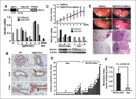 Figure 1. Generation of Tg(NCOA1) mice and mammary tumor metastasis in Tg(Neu) (Neu) and Tg(NCOA1)×Tg(Neu) (NCOA1×Neu) mice. A, the MMTV-hNCOA1 transgene and qPCR analysis of hNCOA1 mRNA expression. RNA was extracted from MGs of WT and Tg(NCOA1) mice and MDA-MB-435 cells. qPCR was performed using hNCOA1 cDNA-specific P1/P2 primers. Human (hNCOA1) and mouse (mNcoa1) are indicated. bGHpA, bovine growth hormone polyadenylation sequence. B, IHC was performed using an antibody that detects both mNcoa1 and hNCOA1. Arrows, NCOA1-overexpressing MECs. MG sections were prepared from female WT and Tg(NCOA1) mice with indicated weeks of ages. C, tumor growth curves were obtained from 27 Tg(Neu) and 26 Tg(NCOA1)×Tg(Neu) mice by measuring tumor volumes (cm3). Tumor specimens were collected at 9 weeks after mammary tumors were palpated and subjected to Western blotting using an NCOA1 antibody that recognizes both hNCOA1 and mNcoa1. β-Actin served as a loading control. Three tumors from each genotype group were assayed. D, the number of tumor cell colonies derived from circulating tumor cells in the blood samples of Tg(Neu) and Tg(NCOA1)×Tg(Neu) mice that had developed mammary tumors for 9 weeks. The Student t test indicated a significant difference (P = 0.001) between the two groups. E, metastatic tumor foci on the lung surfaces and hematoxylin and eosin–stained lung (L) sections with metastatic (M) tumors in Tg(Neu) and Tg(NCOA1)×Tg(Neu) mice. F, lung metastasis indexes are presented as the ratio of tumor area to the total tumor and lung area in Tg(Neu) (n = 15) and Tg(NCOA1)×Tg(Neu) (n = 10) mice.