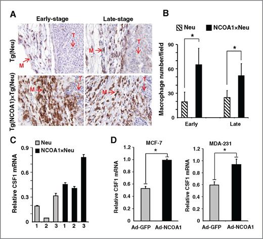 Figure 2. NCOA1 overexpression in mammary tumor cells enhances macrophage recruitment and CSF1 expression. A, immunostaining of macrophages (brown) with F4/80 antibody in Tg(Neu) (Neu) and Tg(NCOA1)×Tg(Neu) (NCOA1×Neu) mammary tumors. T, tumor area; M, macrophage. B, macrophage numbers in Tg(Neu) and Tg(NCOA1)×Tg(Neu) tumors at early and late stages. Macrophages in 10 viewing fields at ×400 magnification were counted on each tumor section. Five tumors were analyzed for each group. Data, mean ± SD. *, P < 0.05. C, qPCR measurement of CSF1 mRNA levels in individual Tg(Neu) and Tg(NCOA1)×Tg(Neu) mammary tumors. D, adenovirus-mediated NCOA1 expression (Ad-NCOA1) in MCF-7 and MDA-MB-231 cells induced CSF1 expression as assayed by qPCR. Adenovirus-mediated GFP expression (Ad-GFP) served as a control.