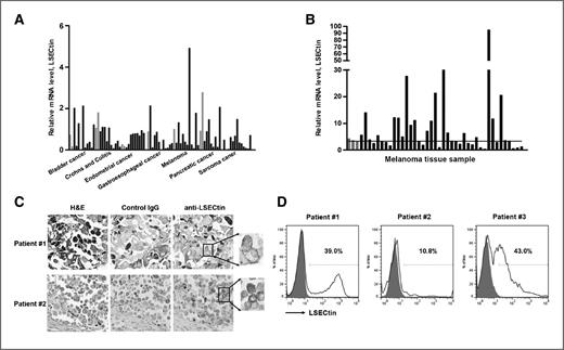 Figure 1. LSECtin is expressed in human melanoma tissues. A, quantitative PCR analysis of LSECtin expression using cDNA from seven different types of human tumor (black) and normal tissues (gray). B, quantitative PCR analysis of LSECtin expression using cDNA from 40 melanoma tumor tissues (black) and three normal tissues (gray). C, immunohistochemical analysis (200× or 400×) of LSECtin expression in human melanoma tissues. H&E, hematoxylin and eosin. D, white histograms demonstrate LSECtin surface expression on gated 7-aminoactinomycin–negative tumor cells from patients with melanoma. Negative controls are shown as gray histograms.