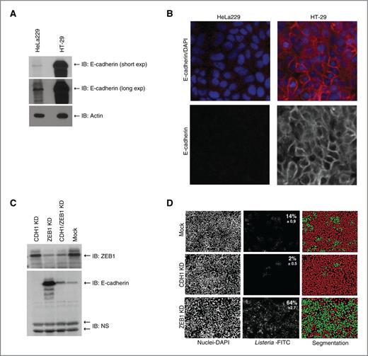 Figure 1. Functional assay for E-cadherin expression. A, E-cadherin expression in epithelial cell lines. E-cadherin expression in HeLa229 and HT-29 cells was detected by Western blot analysis. Actin was used as loading control. B, immunofluorescence was performed for E-cadherin expression in HeLa229 and HT-29 cells grown to confluency for 3 days. C, effect of ZEB1 depletion on E-cadherin expression. HeLa229 cells were transfected with a pool of siRNA duplexes targeting E-cadherin (CDH1) or its transcriptional repressor ZEB1 or both (CDH1/ZEB1). ZEB1 and E-cadherin protein levels were determined by Western blot analysis. D, quantification of L. monocytogenes infection by computer-assisted image analysis. Cells (nuclei-DAPI) infected with GFP-expressing L. monocytogenes (Listeria-FITC) were determined by computer-assisted image analysis. The nuclei of infected and noninfected cells are represented in green and red, respectively (segmentation).