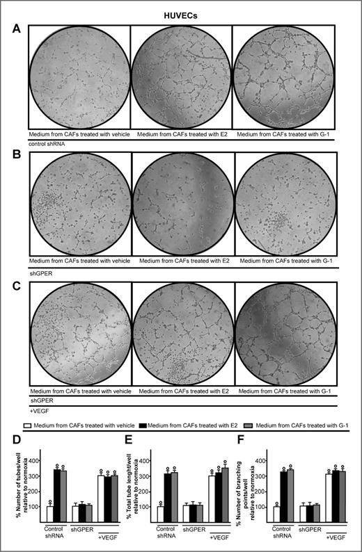 Figure 6. GPER mediates the endothelial tube formation triggered by E2 and G-1. Tube formation was evaluated in HUVECs cultured for 2 hours in medium collected from CAFs transfected for 24 hours with control shRNA (A) or shGPER (B) and then treated for 18 hours with vehicle, 1 nmol/L E2, and 1 μmol/L G-1, as indicated. C, tube formation is rescued using 10 ng/mL VEGF in HUVECs cultured in medium from CAFs, which were transfected for 24 hours with shGPER and then treated for 18 hours with vehicle, 1 nmol/L E2, and 1 μmol/L G-1. Quantification of the number of tubes (D), total tube length (E), and number of branching points (F) observed in HUVECs. Data are representative of three independent experiments performed in triplicate. , P < 0.05 for cells receiving medium of CAFs treated with vehicle versus medium of CAFs treated with ligands.