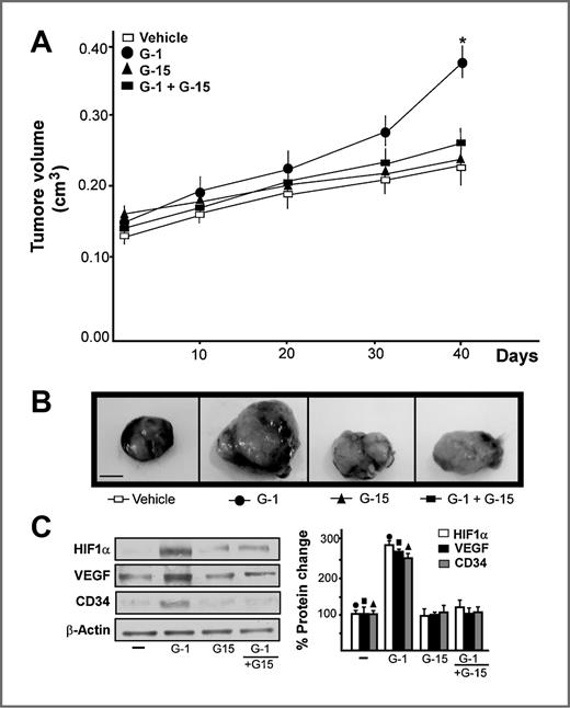 Figure 7. GPER is involved in SkBr3 cells xenograft growth. A, tumor volume from SkBr3 xenografts implanted in female athymic nude mice treated for 40 days with vehicle, G-1 (0.25 mg/kg/die), and G-15 (3.5 mg/kg/die) alone or in combination, as indicated. *, P < 0.05 for G-1–treated animals versus vehicle-treated animals. B, representative images of experimental tumors at day 40; scale bar, 0.3 cm. HIF1α, VEGF, and CD34 protein expression in tumor homogenates from SkBr3 xenografts treated as reported above (C). Side panels show densitometric analysis of the blots normalized to β-actin. , , , P < 0.05 for G-1–treated animals versus vehicle-treated animals.