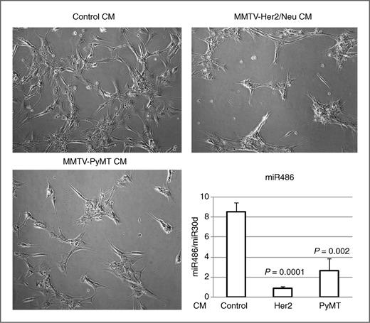 Figure 4. CM from tumor cell lines decrease miR486 expression in differentiated C2C12 cells. C2C12 cells were allowed to undergo differentiation by replacing FBS with horse serum. Phase-contrast images of myotubes under control or CM-treated conditions are shown. The levels of miR486 with or without CM treatment are also shown.