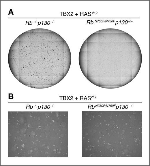 Figure 4. Ablation of the pRB–LxCxE interaction in a p130 null background is not sufficient for anchorage-independent growth upon expression of TBX2 and RASV12. RbN750F/N750Fp130−/− and Rb−/−p130−/− MEFs were infected with pEYK-TBX2 and subsequently with pBABE-RASV12-puro and then plated in soft agar. Pictures were taken after 2 weeks using a non–phase-contrast lens (magnification, ×2.5) in A and a phase-contrast lens (magnification, ×5) in B. RASV12 and TBX2 were expressed at comparable levels in the two cell lines (not shown).