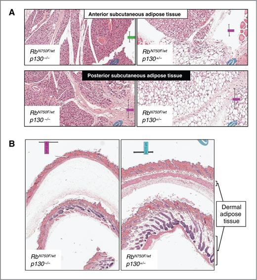 Figure 6. Hematoxylin and eosin staining of skin samples from RbN750F/wtp130−/− (left) and RbN750F/wtp130+/− (right panels). A, staining of subcutaneous adipose depots shows the absence of lipid droplets in RbN750F/wtp130−/− mice and their abundant presence in RbN750F/wtp130+/− mice. B, back skin samples showing the absence of dermal adipose tissue in RbN750F/wtp130−/− mice.