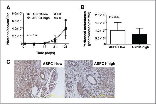 Figure 5. GPR81 is upregulated in the tumor microenvironment. A, tumor growth estimated using bioluminescent imaging of ASPC1-low or ASPC1-high cells stably transfected with luciferase, injected into the tail of the pancreas of athymic nude mice (n = 8/group). B, metastatic disease to the peritoneum estimated using bioluminescent imaging at 4 weeks at the time of sacrifice. Data are mean photon/sec/cm2/sr ± SEM. C, representative images of IHC of GPR81 expression in ASPC1-low or ASPC1-high tumor sections. Scale bar, 200 μm; n ≥ 5 per group. ns, nonsignificant.