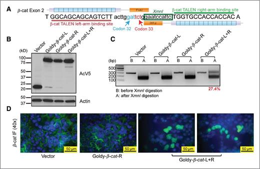 Figure 1. β-Catenin TALENs are effective and efficient in vitro. A, design of β-catenin (β-cat) GoldyTALEN. The target region contains β-catenin codon 32 and 33 and an XmnI cut site between the two TALENs. B, protein expression of β-catenin TALENs in H2.35 cells. H2.35 cells were transfected with GoldyTALEN control vector, single TALENs, or TALEN pairs. Cells were harvested and subjected to Western blot analysis 48 hours after transfection. AcV5 is an epitope tag fused to the TALENs. C, β-catenin TALEN efficiency in H2.35 cells. Genomic DNA was PCR amplified for the region targeted by TALENs and digested by XmnI. The uncut band in A lane is mutated DNA. TALEN efficiency is determined by the ratio of uncut band versus total bands. D, immunofluorescent (IF) staining in H2.35 cells for β-catenin. Cells were fixed 72 hours after transfection and stained for β-catenin (green). Cytoplasmic localization of β-catenin (arrow) is seen in cells treated with the TALEN pair.
