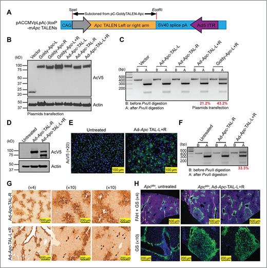 Figure 5. Adenovirus TALEN delivery increases mutagenesis efficiency in vivo. A, the construct map of the adenovirus plasmid containing Apc TALENs. B, protein expression in H2.35 cells transfected with pC-Goldy-mApc TALEN and pACCMVpLpA(-)loxp-mApc TALEN plasmids. C, genotyping of the transfected H2.35 cells. D, protein expression level from the ApcMin liver 24 hours after injection with adenovirus Apc TALENs. E, AcV5 immunofluorescent staining (green) of the ApcMin mice. F, genotyping of treated mice showing an efficiency of about 33.3%. G, IHC staining for GS 3 weeks after adenovirus injection. n = 3 and two independent livers shown here. Ectopic GS+ cells found outside of the central vein region (arrowheads). H, immunofluorescent staining for GS (green) and Fah (red) from the FRG mice. Mice (n = 4) were euthanized 3 months after transplantation with TALEN-treated or -untreated ApcMin hepatocytes.
