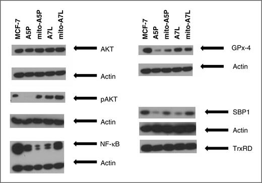 Figure 7. Expression of GPx-1 isozymes affects the levels of signaling and selenium-containing proteins. Protein extracts were prepared from the indicated cells and analyzed using protein-specific antibodies. Actin levels were determined as an indication of equal loading of protein on the gel.