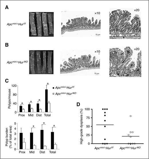 Figure 5. Intestinal HuR deletion attenuates polyposis in Apcmin/+ mice. A and B, left, representative gross morphology of polyps through the entire small intestine from Apcmin/+Hurf/f (A) and Apcmin/+HurIKO mice (B). Middle and right, HuR-stained sections of small intestine showing HuR deletion restricted to the epithelial cell subpopulation; scale bars, 50 μm. C, top, absence of HuR is associated with reduced polyp number per mouse and reduced polyp area in each third of small intestine [bottom; proximal, prox; middle, mid; and distal, Dist; (n = 10 mice/genotype)]; *, P < 0.05. D, trend to reduced high-grade dysplasia in polyps from Apcmin/+HurIKO mice (P < 0.06).