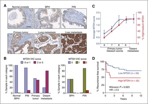 Figure 1. MTDH levels are associated with tumor progression and metastasis in human prostate cancer. Two prostate tumor tissue microarrays were stained with an anti-MTDH antibody. MTDH levels were scored as negative (0), low (1), medium (2), or high (3). A, representative images of MTDH immunostaining of prostate tissue of different stages and distant metastasis. Scale bar, 40 μm. B, left, MTDH expression levels in normal tissues (n = 62) and BPN (n = 10), PIN (n = 10), primary tumors (n = 72), and distant metastasis (n = 10). P < 0.001 by the χ2 test; right, MTDH levels in PIN (n = 10) and BPH (n = 10). P = 0.023 by the χ2 test. C, correlation of MTDH levels with prostate tumor Gleason scores. Blue curve represents average MTDH score (mean ± SEM) and red curve represents the percentage of samples with medium/high levels of MTDH within indicated groups. D, the Kaplan–Meier analysis of recurrence-free survival of patients with prostate cancer based on MTDH expression in their tumors.