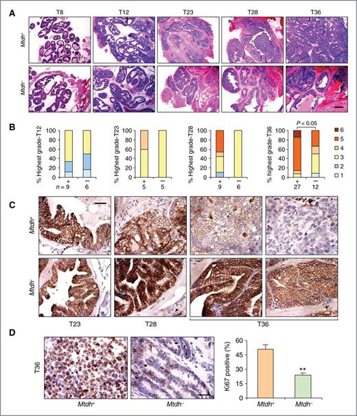 Figure 5. Loss of Mtdh inhibits malignant progression of prostate cancer. A, H&E-stained histologic sections of prostates dissected from TRAMP/Mtdh+ and TRAMP/Mtdh− mice at indicated ages. Scale bar, 200 μm. B, each prostate from mice with indicated genotypes and ages was assigned a single highest grade. + and − indicate TRAMP/Mtdh+ and TRAMP/Mtdh− mice, respectively. Grade scores: 1, normal; 2, low grade PIN; 3, high-grade PIN; 4, well-differentiated adenocarcinoma and phyllode tumor; 5, moderately differentiated adenocarcinoma; 6, poorly differentiated adenocarcinoma and neuroendocrine tumors. The grading scheme followed standard protocol as previously described (23). The numbers at the bottom of each column indicate total number of prostate glands evaluated in each group. P < 0.05 by the χ2 test in T36 group. C, analysis of E-cadherin during prostate tumor progression. Sections from dorsal–lateral lobes were immunostained with an antibody against E-cadherin and images shown are representative of n > 3 animals per group. Scale bar, 25 μm. D, left, representative images of Ki67-stained sections of prostate tumors from 36-week-old TRAMP/Mtdh+ (n = 6) and TRAMP/Mtdh− (n = 3) mice. Scale bars, 25 μm. Right, quantification of Ki67-positive epithelial cells. Data represent mean ± SEM. **, P < 0.01 based on the Student t test.