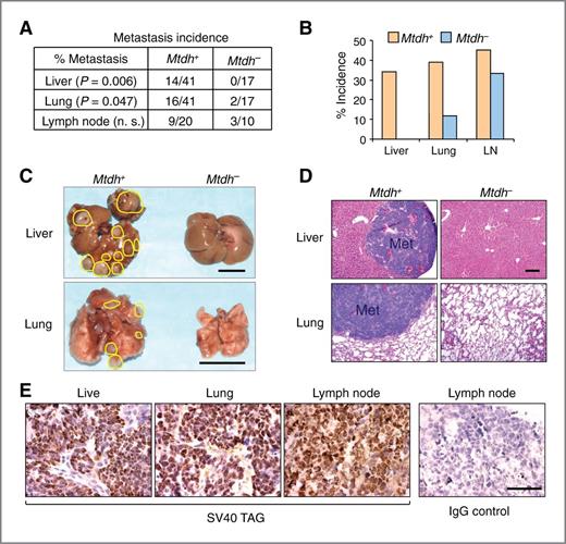 Figure 6. Ablation of Mtdh reduces systemic metastasis of prostate cancer. A, incidence of lung, liver, and lymph node metastasis in cohorts of 1-year-old TRAMP mice with indicated Mtdh genotypes. P values based on the χ2 test. B, bar graph presentation of A. C and D, images (C; scale bar, 1 cm) and H&E-stained sections (D; scale bar, 200 μm) of livers and lungs from mice in A. E, left, representative immunohistochemical staining of SV40 T-antigen oncoprotein in liver, lung, and lymph node metastases; right, IgG control on a section of lymph node metastases. Scale bar, 50 μm.