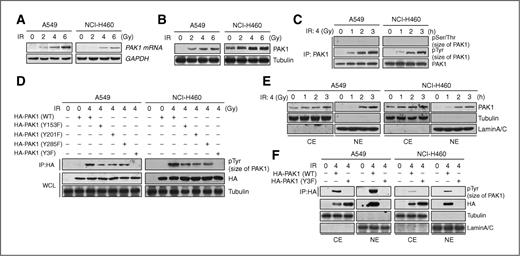 Figure 1. IR induces overexpression, Tyr phosphorylation, and nuclear localization of PAK1 in NSCLC cells. A, IR-induced PAK1 mRNA expression was detected by Northern blot analysis. After irradiation (0, 2, 4, or 6 Gy), the cells were harvested and total RNA was extracted. Total RNA was analyzed using an [α-32P]-labeled PAK1 cDNA probe. GAPDH was used for normalization. B, IR-induced PAK1 protein expression was detected by Western blot analysis. C, IR-induced PAK1 phosphorylation was verified by an in vivo kinase assay. After irradiation (4 Gy) for 0, 1, 2, or 3 hours, the cells were harvested and cell lysates were subjected to an immunoprecipitation (IP) assay with an anti-PAK1 antibody followed by Western blot analysis for pSer/Thr and pTyr. D, IR-induced PAK1 phosphorylation at three Tyr residues (Y153, Y201, and Y285) was confirmed by an in vivo kinase assay using PAK1 Y153F, Y201F, Y285F, and Y3F mutants (WCL, whole cell lysates). Cells were harvested after irradiation (4 Gy) for 2 hours and cell lysates were immunoprecipitated with an anti-HA antibody and analyzed by Western blot analysis for pTyr. E, IR-induced translocation of PAK1 from the cytoplasm into the nucleus was assayed by Western blot analysis after cytoplasmic or nuclear fractionation (CE, cytoplasmic extract; NE, nuclear extract). Tubulin and Lamin A/C were used as markers for the CE and NE, respectively. F, involvement of IR-activated nuclear localization and phosphorylation of PAK1 was determined by an immunoprecipitation assay and Western blot analysis. After irradiation, the cells transiently transfected with PAK1 (WT or Y3F mutant) were harvested to conduct cytoplasmic or nuclear fractionation. Each extract was immunoprecipitated with an anti-HA antibody and detected by Western blot analysis using an anti-pTyr antibody.