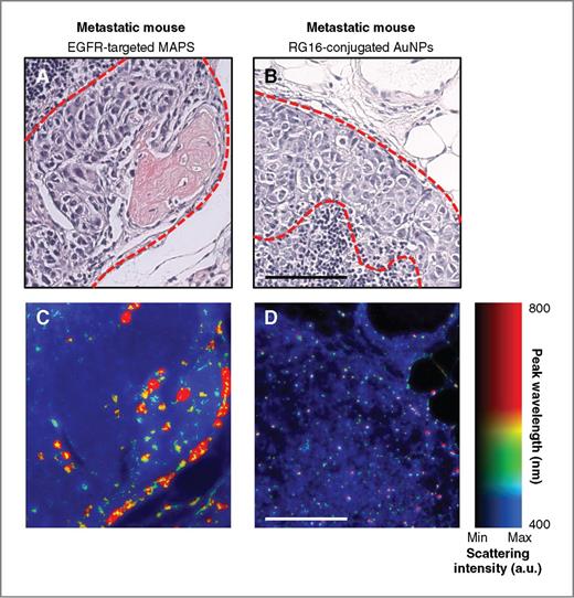 Figure 7. Optical hyperspectral microscopy of specific nanoparticle uptake and plasmon resonance coupling of MAPS. H&E stains of metastases (dashed red outline) in mice injected with either EGFR-targeted MAPS (A) or RG16-targeted AuNPs (B). C and D, dark-field reflectance hyperspectral microscopy of adjacent tissue slices shows tumor cell uptake of EGFR-targeted MAPS and plasmon resonance coupling between the MAPS as evident from a strong red-NIR shift in their plasmon resonances, with no plasmon resonance coupling observed after the injection of RG16-targeted AuNPs. The color in C and D indicates the wavelength of peak scattering intensity, while the brightness indicates the magnitude of scattering; the range of colors is depicted in the color bar. Scale bars, 100 μm.