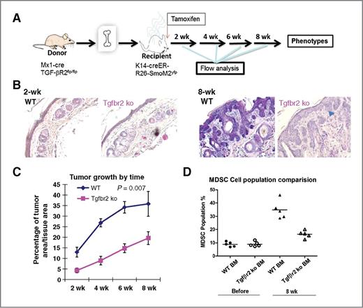 Figure 4. Effects of Tgfbr2 deficiency in bone marrow-derived cells for SmoM2-induced tumor development. A, a diagram of the experimental design. Before bone marrow transplantation, recipient mice were irradiated (1 × 7 Gy and 1 × 4 Gy with 4 hours in between) before tail vein injection with 5 × 106 bone marrow cells per mouse. Tamoxifen was used to induce cre expression in K14-positive cells (keratinocytes); peripheral blood and tail skin biopsies were collected at different time points for analyses. B, H&E staining of skin sections from SmoM2-derived skin tumors with wild-type (WT; left) or Tgfbr2-deficient (right) bone marrow-derived cells before SmoM2 induction. C, tumor growth in mice with WT (blue) or Tgfbr2 deficiency (pink) in bone marrow-derived cells. The difference of tumor growth between the two groups was statistically significant (P = 0.007 by the Student t test; matched groups and two tailed). The time shown in this figure was the weeks after SmoM2 induction. D, the level of CD11b+Gr1+ cells in peripheral blood of different mice.