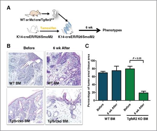 Figure 5. Effects of Tgfbr2 knockout in BM-derived cells on existing SmoM2-derived tumors. A, a diagram of the experimental design. In brief, SmoM2 was first induced by tamoxifen before bone marrow (BM) transplantation. Six weeks later, skin biopsies were collected for histology analyses. B, H&E staining of skin sections with WT (top) or Tgfbr2 deficiency (bottom) in the bone marrrow (BM)-derived cells after SmoM2 induction. C, the percentage of tumor areas in different groups of mice.