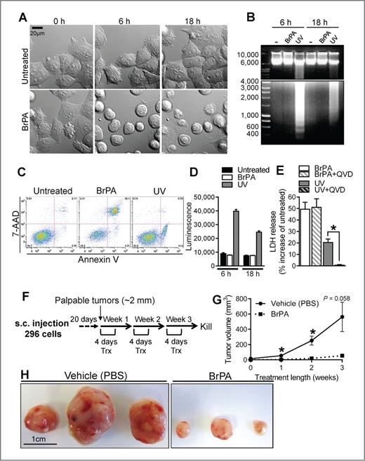 Figure 6. BrPA induces necrosis and impairs endometrial tumor growth in vivo. A, phase contrast images of 296 cells, untreated or treated, with BrPA (100 μmol/L). B, DNA fragmentation in untreated, BrPA-treated, or UV-irradiated (150,000 μJoules/cm2) 296 cells. C, AV/7-AAD staining of 296 cells following BrPA treatment or UV irradiation (24-hour BrPA treatment, 5-hour after UV irradiation). D, caspase-3/7 activity in 296 cells following BrPA treatment or UV irradiation. E, LDH release in 296 cells treated with BrPA (±QVD) or UV-irradiated (±QVD; 18 hours posttreatment). LDH release is calculated as a percentage increase of untreated cells. All in vitro data represent the mean of at least three independent experiments ± SEM. F, schematic of BrPA dosing in mice. G, growth of 296 tumors in mice treated with vehicle or BrPA (2.5 mg/kg; n = 3). Data points represent the mean tumor volume ± SEM. H, 296 tumors from mice treated with vehicle (PBS) or BrPA (*, P < 0.05).