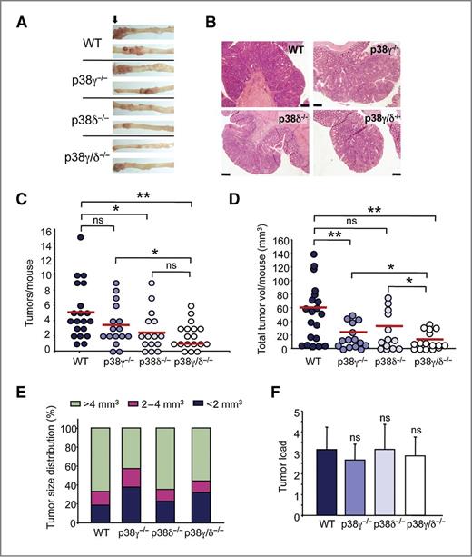 Figure 1. Reduced incidence of CAC cancer in p38γ/δ−/− mice. WT, p38γ−/−, p38δ−/−, and p38γ/δ−/− mice were treated with AOM/DSS, and colon tumors were analyzed at week 15. A, representative colons showing tumors in the distal region (arrow). B, representative H&E-stained colon sections showing colon tumors; bars, 200 μm. C, tumors were counted at week 15. Dot, a single mouse. D, total tumor volume calculated by summing all tumor volumes for a given mouse. Dot, a single mouse; ns, not significant; *, P ≤ 0.05; **, P ≤ 0.01. E, histogram showing tumor size distribution in C and D. F, tumor average size was the mean of tumor volumes for a given mouse. Results are mean ± SD (n = 15–20 mice/group); ns, not significant.