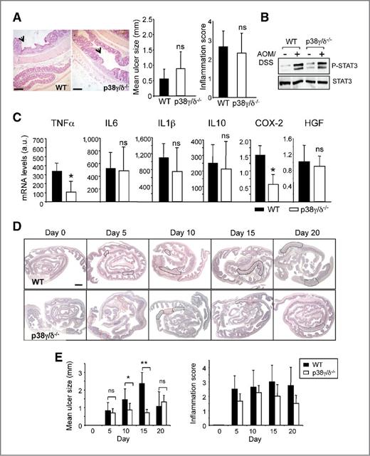 Figure 2. p38γ and p38δ deletion have no major impact on chronic inflammation and decreased acute inflammation. A, representative H&E staining of WT and p38γ/δ−/− mouse colon showing ulcers (arrow) 9 weeks after initiation of AOM/DSS treatment; bars, 100 μm. Mean ulcer size and inflammation score were quantified (see Materials and Methods). Results show mean ± SD (n = 6 mice/group); ns, not significant. B, colon extracts (50 μg) from control or AOM/DSS–treated WT and p38γ/δ−/− mice were immunoblotted with antibodies to phospho and total STAT3. Representative blots from three independent experiments. C, at 9 weeks after initiation of AOM/DSS treatment, relative mRNA expression was determined by qPCR for indicated genes in WT (black) and p38γ/δ−/− (white) mouse colon and normalized to 18S and GAPDH mRNA. Data, mean ± SD (n = 5–8); ns, not significant; *, P ≤ 0.05, relative to WT mice. D, WT and p38γ/δ−/− mice were treated with 3% DSS for 5 days. Colon samples were examined at times indicated. Representative H&E-stained colon sections analyzed at indicated times. Ulcers and inflammation areas are marked by black and red lines, respectively. E, mean ulcer size and inflammation score were quantified. Data, mean ± SD (n = 5–6); ns, not significant; *, P ≤ 0.05; **, P < 0.01.
