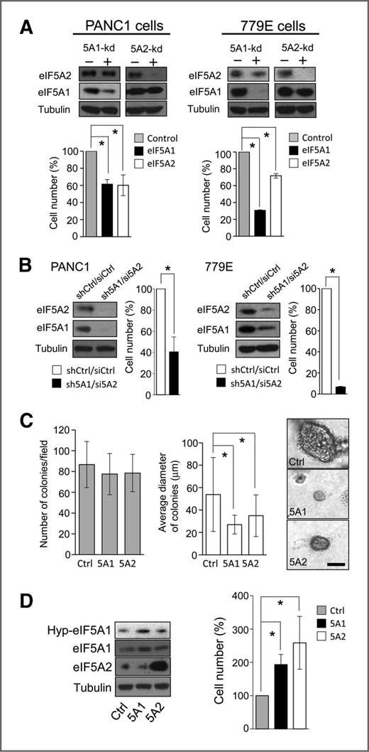 Figure 4. eIF5A proteins are necessary and sufficient for PDAC cell proliferation in vitro. A, bar graphs represent viable cell number of PANC1 or 779E cells containing eIF5A1 or eIF5A2 shRNAs (5A1-kd and 5A2-kd, respectively) relative to control shRNA-containing cells after 7 days of growth. Top panels show corresponding Western blot analyses for tubulin (loading control), eIF5A1, and eIF5A2. B, the number of viable PANC1 and 779E cells containing both eIF5A1 shRNA and eIF5A2 siRNA (sh5A1/si5A2) was determined as in A and is shown relative to control cells containing shRNA and siRNA (shCtrl/siCtrl). Tubulin (loading control), eIF5A1, and eIF5A2 protein levels were determined as in A. C, PANC1 cells containing control (Ctrl), eIF5A1 (5A1), or eIF5A2 (5A2) shRNAs were grown in soft agar for 25 days, and the average number of colonies and their average diameter were determined as indicated in Materials and Methods. Right, representative phase-contrast photomicrographs of Ctrl, 5A1, and 5A2 cell colonies in soft agar. Bar, 200 μm. D, bar graph represents viable cell number of PANC1 cells overexpressing eIF5A1 (5A1) or eIF5A2 (5A2) relative to mock-transfected (Ctrl) cells after 7 days of growth. Western blot analyses show the expression levels of eIF5A1, eIF5A2, and hypusinated eIF5A1 (Hyp-eIF5A1). *, P < 0.05, as determined by the Student t test.