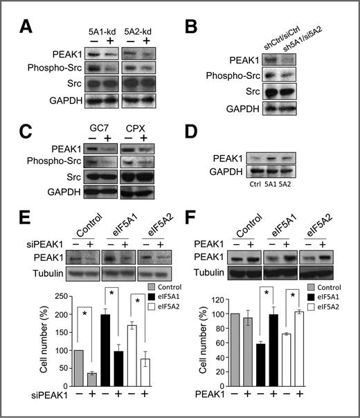 Figure 6. eIF5A proteins regulate PEAK1 protein levels to drive PDAC cell proliferation in vitro. A, PANC1 cells expressing eIF5A1 (5A1-kd) or eIF5A2 (5A2-kd) shRNAs were Western blotted for PEAK1, total and kinase activated/phosphorylated (Y416) Src, and GAPDH. B, PANC1 cells containing both eIF5A1 shRNA and eIF5A2 siRNA (sh5A1/si5A2) or expressing control shRNA and siRNA (shCtrl/siCtrl) were Western blotted as in A. C, PANC1 cells treated with GC7 (40 μmol/L) or CPX (5 μmol/L) for 72 hours were Western blotted as above. D, PANC1 cells containing control (Ctrl), eIF5A1- (5A1), or eIF5A2-expressing vectors (5A2) were Western blotted for the indicated proteins. E, bar graphs represent viable cell number in control, eIF5A1-, or eIF5A2-overexpressing PANC1 cells also transfected with PEAK1 siRNA (siPEAK1) after 7 days of growth. Results are shown relative to control siRNA-transfected cells. F, cell growth was measured as in E for PANC1 cells expressing eIF5A1 or eIF5A2 shRNAs also transfected with either control or PEAK1-expressing vectors. Corresponding Western blots from lysates of cells after 7 days of growth show the expression levels of PEAK1 and tubulin. *, P < 0.05, as determined by the Student t test.