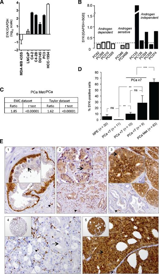 Figure 2. SYK is expressed in human prostate cancer. A, SYK RNA expression determined by qPCR in indicated cell lines. MDA-MB-435S (hypermethylated SYK gene promoter; refs. 27, 28) and HCC-1954 breast cancer cells (high SYK expression; ref. 28) were used as negative and positive controls, respectively. B, SYK RNA expression in human prostate cancer resection specimens xenografted in mice. C, ratio between SYK RNA expression in prostate cancer metastases [prostate cancer (PCa) Met] and primary prostate cancers and significance (t test) in two different datasets. D, semiquantitative analysis (mean and SEM) of SYK expression in normal luminal epithelium, primary prostate cancer, and prostate cancer lymph node metastases. E, IHC detection of SYK in human benign glandular prostate epithelium (1; note staining of basal but rarely of luminal cells), prostate adenocarcinoma (2, weak; and 3, moderate SYK expression), and prostate lymph node metastasis (4, negative; and 5, strong SYK expression). Arrows point to prostate epithelial/cancer cells. Original magnifications, ×200 (1, 4, 5) and ×100 (2, 3). Strong staining in lymphocytes served as internal positive control in all cases (arrowheads). ns, nonsignificant; **, P < 0.005; ***, P < 0.001 (Mann–Whitney U test).