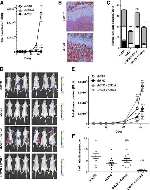 Figure 4. SYK kinase activity supports metastatic bone colonization in mice. A, total metastatic tumor burden determined by BLI monitoring at indicated time points following intracardiac inoculation in immune-compromised mice for PC3M-Pro4luc variants expressing indicated lentiviral shRNAs (data obtained from at least 9 mice per experimental group). B, bones of mice collected 31 days after intracardiac inoculation with PC3M-Pro4-luc shCTR or shSYK cells and stained with Goldner staining. *, tumor lesion. C, quantification of colony formation assay for PC3M-Pro4-luc cells expressing control or SYK shRNAs in combination with wild-type (SYKwt) or kinase dead SYK (SYKkd) expression vectors. Gray, small; white, medium; black, large colonies. D, BLI images of PC3M-Pro4luc variants expressing control or SYK shRNAs in combination with wild-type (SYKwt) or kinase dead (SYKkd) expression vectors taken 31 days following intracardiac inoculation. E and F, quantification of the experiment shown in D where total metastatic tumor burden was determined by BLI monitoring at indicated time points (E) and the number of metastatic colonies was determined by counting of BLI foci at 31 days following intracardiac inoculation (data obtained from at least 10 mice per experimental group; F). ns, nonsignificant; *, P < 0.05; **, P < 0.01; ***, P < 0.005 versus shCTR.