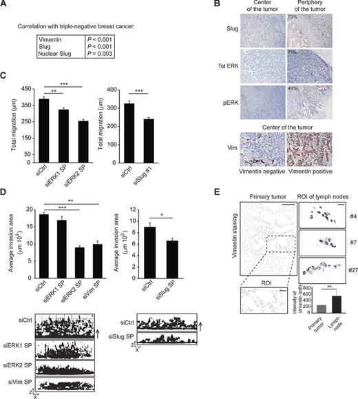 Figure 1. Vimentin, ERK, and Slug are coexpressed in breast cancer and regulate breast cancer cell migration and invasion. A, table outlining the significant and positive correlation between the triple-negative status of breast carcinomas and vimentin and Slug staining (n = 356). B, IHC staining of a representative triple-negative patient carcinoma sample with Slug, ERK, and pERK T202/Y204 (n = 30–40 samples). The numbers indicate the proportion (%) of samples positive for the staining. Representative images of a vimentin-positive and -negative triple-negative carcinoma sample are also included. The overall proportion (%) of cells expressing the respective proteins indicated in the IHC images is shown. C, migration of control, ERK1 or ERK2 smart pool (SP), or Slug-silenced MDA-MB-231 cells (n = 38–56 cells; shown are representatives of three experiments). D, MDA-MB-231 cells were allowed to invade for 4 days in Matrigel following ERK1, ERK2, vimentin, or Slug silencing. Shown are representative micrographs of phalloidin-stained invading cells (z-stack, side-view). Arrows, direction of invasion (quantification of eight invasion areas per experiment; n = 3). E, IHC staining of vimentin in orthotopically implanted MDA-MB-231 primary tumors and representative contralateral lymph node metastasis from three animals (n = 7 lymph node lesions and n = 5 primary tumors). Scale bar, 300 and 100 μm for region of interest (ROI) images (mean ± SEM; *, P < 0.05; **, P < 0.001; ***, P < 0.0001).