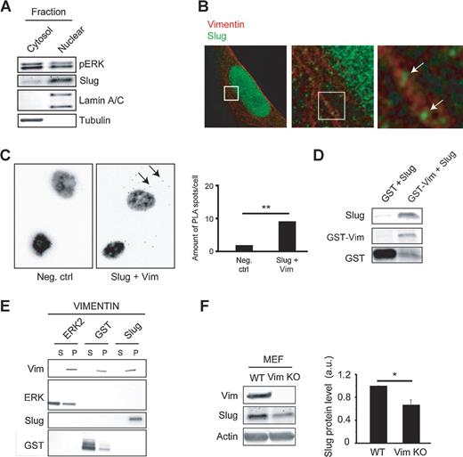 Figure 4. Slug and ERK interact with vimentin. A, representative Western blot analysis of Slug and ERK localization in fractionated MDA-MB-231 cells (nuclear and cytosolic fractions). Lamin A/C and tubulin were used as markers of nuclear and cytosolic fractions, respectively (n = 4). B, ultra-high resolution STED microscopy of vimentin and Slug staining in MDA-MB-231 cells. Arrows, Slug staining along vimentin filaments. C, PLA analysis of endogenous Slug–Vim complex formation in MDA-MB-231 cells. Arrows, representative PLA signals. PLA between GFP and vimentin was used as a negative control. Quantification of the amount of PLA spots is shown on the right. Scale bar, 10 μm. D, analysis of Slug and GST-vimentin interaction in GST pulldowns. GST alone was used as a negative control. Representative blots are shown (n = 3). E, in vitro cosedimentation of recombinant active ERK2, GST or Slug, and recombinant polymerized vimentin as indicated. Immunoblotting analysis of sedimentated protein fractions (pellet) and soluble proteins (supernatant). F, quantification of Slug levels in WT MEF and Vim KO MEFs (mean ± SEM; **, P < 0.01; n = 4).