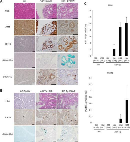 Figure 2. ADM and PanIN lesions developed in AID Tg mice. A, immunohistochemical analysis of ADM (middle panels) and PanIN (right) lesions that developed in AID Tg mice and acinar cells in WT mice (left) at 13 months of age. ADM expressed amylase (acinar marker) and CK19 (ductal marker). PanIN lesions expressed CK19 and weakly expressed amylase. Alcian blue staining showed acidic mucin content in PanIN lesions, but not in ADM. ADM and PanIN lesions also expressed p-Erk1/2 (AMY, amylase; CK19, cytokeratin 19; p-Erk1/2, phospho-Erk1/2; scale bars, 100 μm). B, AID Tg mice developed a few ADM lesions (CK19, positive; Alcian blue staining, negative) at 6 months of age (arrowhead, left). On the other hand, AID Tg mice developed many PanIN lesions (CK19, positive; Alcian blue staining, positive) at 13 months of age (arrowhead in the middle and on the right; M, months of age; scale bars, 200 μm). C, AID Tg mice developed ADM and PanIN lesions by 6 and 11 months of age, respectively. The frequencies of these lesions increased with age. On the other hand, WT mice developed no precancerous lesions (n, number of mice). Data, mean SEM of the number of ADM or PanIN lesions per optical field.