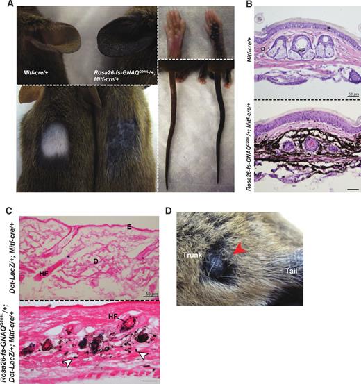 Figure 2. Melanocyte overgrowth in the dermis and hair follicles of Rosa26-floxed stop-GNAQQ209L/+; Mitf-cre/+ mice. A, hyperpigmentation of ears, footpad, trunk, and tail of 3-month-old Rosa26-floxed stop “fs” -GNAQQ209L/+; Mitf-cre/+ mice (right animal of each subpanel). B, hyperpigmentation of the tail dermis at 3 months of age (hematoxylin and eosin). C, X-gal and eosin staining of Rosa26-floxed stop-GNAQQ209L/+; Dct-LacZ/+; Mitf-cre/+ 5-month-old trunk skin reveals hyperpigmentation of the hair follicles and dermis (white arrowheads) and LacZ-positive cells (blue). D, a dermal lesion (red arrowhead) on the trunk. D, dermis; E, epidermis; HF, hair follicle.