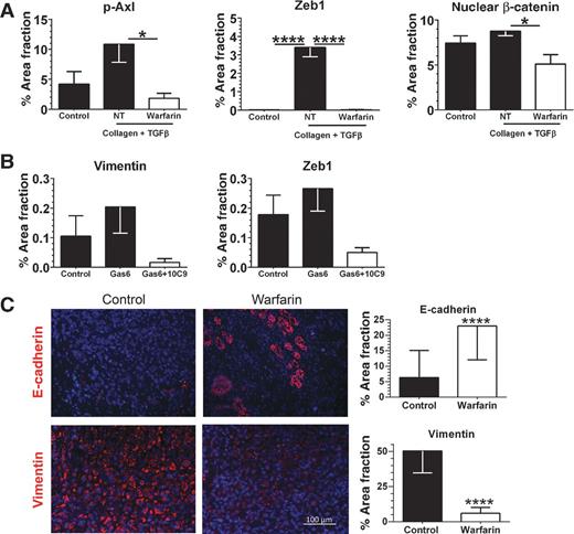 Figure 4. Warfarin inhibits Axl-dependent maintenance of EMT. A, the expression level of pAxl, Zeb1, and nuclear β-catenin in Panc1 cells in vitro was measured by immunofluorescence under normal culture conditions or after growth on collagen matrix and treatment with TGFβ (20 ng/mL) to induce epithelial-to-mesenchymal transition, with or without warfarin (2 μmol/L). p-Axl was normalized to total Axl area. B, Panc1 cells were treated with either SFM, recombinant Gas 6 (100 ng/mL), or Gas6 following pretreatment with 10C9 (mAb anti-Axl). Transition to a mesenchymal phenotype was characterized by changes in vimentin and nuclear Zeb1 expression determined by immunofluoresence. A and B, data are displayed as mean ± SEM and represent five images per chamber, with assay performed in triplicate. The percentage of area per image was normalized to cell number. Images were analyzed using Elements software. *, P < 0.05; ****, P < 0.001 by ANOVA with Tukey's MCT. C, paraffin-embedded sections of Panc-1 tumors were analyzed by immunofluorescence for markers of EMT. Representative images of E-cadherin and vimentin are shown. Total magnification, ×200; scale bar, 100 μmol/L. Images were analyzed using Elements software; quantification of the percentage of area fraction is shown. Data are displayed as mean ± SD and represent five images per tumor with 5 animals per group analyzed; ****, P < 0.0001 by the t test.