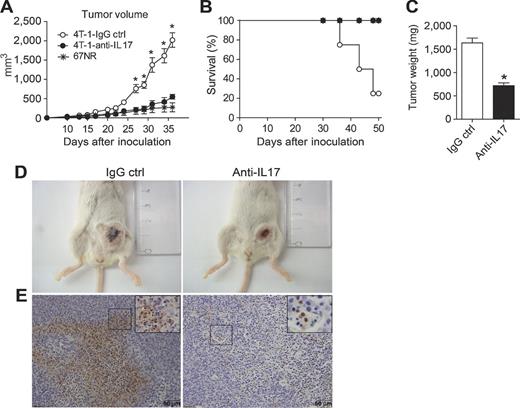 Figure 2. Treatment with anti-IL17 inhibits the growth of murine mammary tumors. BALB/c mice were subjected to an induction protocol with mammary tumor cells (4T1, squares) or treated with neutralizing anti-IL17A (filled squares) or rat immunoglobulin (IgG control; open squares) antibodies or 67NR (asterisks). A, the volume of the tumors was measured at 10 dpi. B, the percentage of survival was assessed daily. C, at 35 dpi, the weight of the tumors was measured. The data shown are representative of two independent experiments with similar results and are shown as the mean ± SEM of five mice per group (*, P < 0.05). D, photographs show representative tumors in mice treated with the IgG control (left) or anti-IL17 antibodies (right) at 35 dpi. E, immunohistochemical staining in tumor tissue of the mice treated with the IgG control (left) or anti-IL17 mAb (right) at 35 dpi was used to detect Ly6G protein; scale bars, 50 μm.