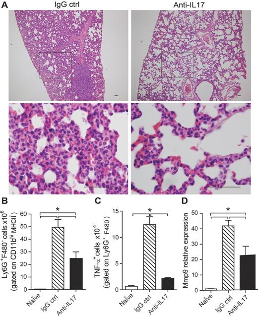 Figure 3. Blockade of IL17 inhibits neutrophil recruitment to the lung in a metastatic mammary tumor model. BALB/c mice were subjected to an induction protocol with mammary tumors and treated with anti-IL17A or IgG control antibodies. A, representative H&E-stained sections of lung tissue collected at 35 dpi; original magnification, ×10 (top) and ×100 (bottom); scale bars, 50 μm. B and C, flow cytometric analysis of the numbers of neutrophils (Ly6G+F4/80−) gated on CD11b+MHCII− cells (B) and TNFα+ cells gated on Ly6G+MHCII− cells (C) after isolation from the lung and stimulation with 100 μg/mL of LPS for 6 hours. D, mRNA was isolated from fragments of lung tissue from both groups at 35 dpi, and the relative expression of MMP-9 was evaluated by qPCR. The data shown are representative of two independent experiments with similar results and are shown as the mean ± SEM of five mice per group (*, P < 0.05).