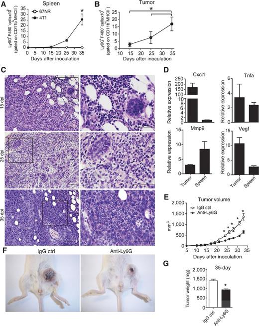 Figure 4. Increased numbers of neutrophils and expression of genes related to the tumorigenic neutrophils phenotype in metastatic murine mammary tumors. BALB/c mice subjected to an induction protocol with nonmetastatic (67NR) and metastatic (4T-1) mammary tumor cells at day 0, 15, 25, and 35 dpi. The numbers of neutrophils (Ly6G+F480−) gated on CD11b+MHCII− cells were analyzed in the population of granulocytes isolated from the spleens (A) and tumors (B) by flow cytometry. C, representative, H&E-stained sections of the tumor microenvironment collected at 15, 25, and 35 dpi; original magnification, ×10 (left) and ×100 (right); scale bars, 50 μm. D, Ly6G+F4/80− cells gated on CD11bhiMHCII− cells were sorted from the spleens and tumors of 4T-1 tumor-bearing mice, and the expression of MMP-9, VEGF, TNFα, and CXCL1 was analyzed by qPCR. The data shown are normalized to β-actin expression. The data shown represent the means ± SEM compared with Ly6G+F4/80− cells isolated from the spleens of naïve mice. E, the volume of the tumors obtained from BALB/c mice subjected to an induction protocol with mammary tumor cells and treated with anti-Ly6G or rat immunoglobulin (IgG control) antibodies was measured at 10 dpi. F, photographs are representative of tumors in mice treated with IgG control (left) or anti-Ly6G (right) antibodies. G, at 35 dpi, the weight of the tumors was measured. Data are representative of two independent experiments with similar results and are shown as the mean ± SEM of four mice per group (*, P < 0.05).