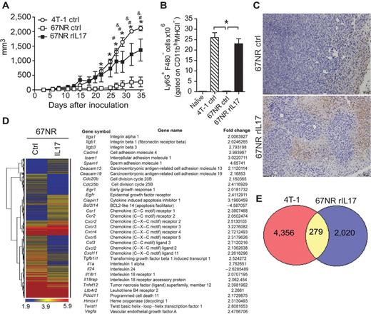 Figure 6. IL17A directly affects breast cancer tumor cell behavior in vivo. 67NR cells were either treated or not treated with rIL17 in vitro, and after 48 hours, these cells were used to inoculate BALB/c mice to induce mammary tumors. A, the volumes of the tumors were measured at 5 dpi and monitored daily. B, at 35 dpi, the numbers of neutrophils (Ly6G+F4/80−) gated on CD11b+MHCII− cells were analyzed in the population of granulocytes isolated from the spleen by flow cytometry. C, immunohistochemical staining in tumor tissues of the mice receiving untreated 67NR cells (top) or treated with rIL17 (bottom) at 35 dpi was used to detect Ly6G protein. The data are representative of two independent experiments with similar results and are shown as the mean ± SEM of four mice per group (*, P < 0.05). 67NR cells were either treated or not treated with rIL17. After 48 hours, the mRNA was extracted, and the gene-expression profiles were analyzed by a microarray. D, heat map displaying the hierarchical clustering of the gene-expression profiles. The table presents selected differentially expressed genes of interest. The complete list of the differentially expressed immune response is presented in Supplementary Tables S2 and S3. E, the Venn diagram shows the number of upregulated genes in the 4T-1 cells and IL17-pretreated 67NR cells in relation to the untreated 67NR cells. The intersection of the diagram indicates the number of upregulated genes in common between the 4T-1 and IL17-pretreated 67NR cells.