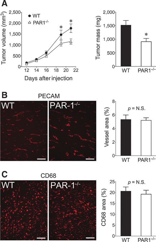 Figure 4. Stromal cell–associated PAR-1 promotes colon cancer growth. A, comparison of tumor growth following injection of MC38 cells into the dorsal subcutis of WT and PAR1−/− mice; n = 8/cohort; *, P < 0.05. B, qualitative tumor vasculature as visualized by immunofluorescence staining using an anti-PECAM antibody as well as quantitative measurements of vascular density based on ImageJ analyses of 10 images per tumor were similar between genotypes. C, qualitative and quantitative analyses of TAMs based on immunofluorescent staining of CD68 were also similar in tumors harvested from WT and PAR1−/− mice. Note that TAMs were quantitated as a function of the total tumor tissue area from 8 images taken from each tumor using ImageJ software; size bars, 100 μm.