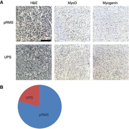 Figure 1. STSs resembling UPS or pleomorphic rhabdomyosarcoma (pRMS) arise in P7KP mice following recombination with i.m. 4OHT. A, representative sections are shown for sarcomas resembling UPS and pRMS. An H&E-stained section is shown for each sarcoma subtype in addition to IHC with antibodies directed against MyoD and myogenin. B, histologic distribution of sarcomas in P7KP mice treated with i.m. 4OHT.
