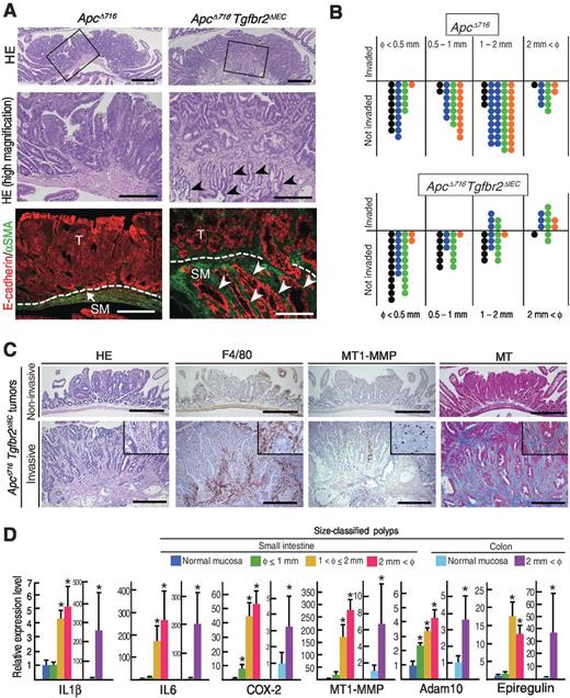 Figure 1. Size-dependent submucosal invasion of intestinal tumors. A, representative photographs of ApcΔ716 mouse benign adenomas (left) and ApcΔ716 Tgfbr2ΔIEC mouse invasive adenocarcinomas (right). H&E (top) and enlarged images of the boxed areas (middle), and fluorescence immunohistochemistry for E-cadherin (red) and αSMA (green; bottom). T, tumor; SM, submucosa. Arrowheads, submucosal invasion of tumor epithelial cells. Bars, 400 μm (top) and 200 μm (middle and bottom). B, size classification of intestinal tumors of ApcΔ716 mice (top) and ApcΔ716 Tgfbr2ΔIEC mice (bottom) scored using “Swiss roll” histology sections. Each dot indicates an individual polyp. Different colors indicate independent mice. C, representative photographs of noninvasive (top) and invasive polyps (bottom) of ApcΔ716 Tgfbr2ΔIEC; mice. H&E staining, immunohistochemistry for F4/80 and MT1-MMP, and Masson trichrome (MT) staining (left to right). Insets, high-powered magnification. Bars, 200 μm (top) and 400 μm (bottom). D, expression levels of the indicated factors relative to the mean level of normal mucosa in size-classified small intestinal and colon tumors of ApcΔ716 mice (mean ± SD). *, P < 0.05 compared with the normal mucosal level.