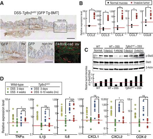 Figure 3. Chronic inflammation in invasive tumors of Tgfbr2ΔIEC mice. A, representative photographs of immunohistochemistry for GFP in a DSS-treated Tgfbr2ΔIEC mouse that had undergone BM transplantation from a GFP transgenic mouse (top). Enlarged images of invasive (bottom left) and noninvasive (bottom center) mucosa of the boxed areas (top). Fluorescent immunostaining for F4/80 (green) and E-cadherin (red) in an invasive tumor (bottom right). Bars, 400 μm (top) and 200 μm (bottom). B, relative expression levels of the indicated chemokines in the invasive tumors in DSS-treated Tgfbr2ΔIEC mice to the mean level of wild-type mouse colons (mean ± SD). *, P < 0.05. C, immunoblotting for phosphorylated Stat3 and total Stat3 in the colon mucosa of control wild-type mice (WT), DSS-treated wild-type and Tgfbr2ΔIEC mice. β-Actin was used as an internal control. uc, ulcerative colitis; rep, repaired mucosa; inv, invasive tumor. The band intensities for pStat3/Stat3 relative to the mean level of wild-type mice (red bar) are shown in a bar graph (bottom). D, expression levels of cytokines, chemokines, and COX-2 in DSS-treated wild-type or Tgfbr2ΔIEC mouse colonic mucosa relative to the mean levels of the repaired mucosa (green; mean ± SD). *, P < 0.05. ns, not significant.