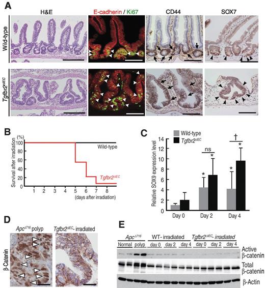 Figure 5. Impaired mucosal regeneration by suppression of TGFβ signaling. A, representative photographs of X-ray–irradiated wild-type (top) and Tgfbr2ΔIEC (bottom) mouse small intestines 6 days after irradiation. H&E staining, fluorescence immunostaining for E-cadherin (red), and Ki67 (green), immunohistochemistry for CD44 and SOX7 (left to right) are shown. White arrowheads, Ki67-positive cells. Arrows, CD44-positive epithelial cells; closed arrowheads, SOX7-positive epithelial cells. Bars, 200 μm (left) and 100 μm (center and right). B, survival curve of wild-type and Tgfbr2ΔIEC mice after X-ray irradiation at 9 Gy. C, expression levels of SOX9 in X-ray–irradiated wild-type (gray bars) and Tgfbr2ΔIEC (closed bars) mouse intestines relative to the mean level of nonirradiated wild-type mice (day 0; mean ± SD). *, P < 0.05 versus day 0 level; dagger, P < 0.05. ns, not significant. D, immunohistochemical staining for β-catenin in an ApcΔ716 mouse intestinal polyp (left) and irradiated Tgfbr2ΔIEC mouse small intestinal mucosa (right). White arrowheads, β-catenin nuclear accumulation. Bars, 25 μm. E, immunoblotting for active β-catenin and total β-catenin in the indicated intestinal tissues. β-Actin was used as an internal control.