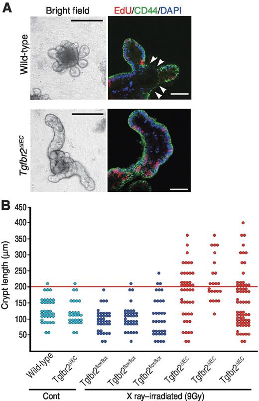 Figure 6. Acquisition of invasive phenotype by TGFβ inhibition in regenerating epithelia. A, representative bright-field photographs of organoid cultures in Matrigel (left) and confocal images of organoids immunostained for EdU (red) and CD44 (green; right) of wild-type (top) and X-ray–irradiated Tgfbr2ΔIEC (bottom) mouse intestinal epithelia. Arrowheads, EdU-negative and CD44 weak cells in wild-type organoid. Bars, 200 μm (left) and 50 μm (right). B, crypt lengths of organoids derived from wild-type and nonirradiated Tgfbr2ΔIEC mice (light blue), irradiated Tgfbr2flox/flox (control) mice (blue), and irradiated Tgfbr2ΔIEC mice (red). Red bar, 200-μm threshold, and crypts longer than 200 μm were judged to be long crypts.