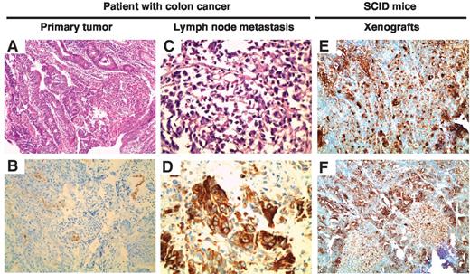 Establishment and Characterization of a Cell Line from Human ...