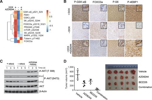 Figure 2. A, heatmap generated from RPPA analysis (mean values from three independent lines) of PI3K–AKT effector proteins from iKRAS cells cultured with doxycycline (KRASG12D expressed), 48 hours after doxycycline withdrawal (KRASG12D ablated), or in the presence of doxycycline after a 48-hour exposure to 2 μmol/L AZD6244. B, representative IHC of AKT–mTOR effector proteins P-GSKα/β, FOXO3a, P6S, and P-4EBP1 in iKRAS-derived allografts. When tumors became palpable mice were maintained with doxycyline (KRASG12D expressed) with or without 100 mg/kg AZD6244 daily treatment or removed from doxycycline (KRASG12D ablated). For immunohistochemical evaluation, tumors were collected 5 days after the beginning of treatment or doxycycline withdrawal. C, time course of AKT phosphorylation levels on residues T308 and S473 in iKRAS cells with continuous KRASG12D expression, after KRASG12D ablation, or in KRASG12D-expressing cells treated with 2 μmol/L AZD6244. D, macroscopic tumor appearance (right) and tumor volumes (left) from iKRAS allografts from mice treated with vehicle, 100 mg/kg every day AZD6244, 40 mg/kg every day BEZ235, or combined AZD6244 plus BEZ235. Treatments were started when tumors became palpable and continued until excessive tumor burden or ulcerations occurred.