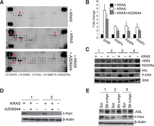 Figure 3. A, phospho-RTK array of iKRAS-derived allografts from mice receiving doxycycline (KRASG12D expressed), after doxycycline withdrawal (KRASG12D ablated), or treated with 100 mg/kg AZD6244 daily in the presence of doxycycline. Tumors were collected 5 days after the beginning of the treatment or doxycycline withdrawal. B, expression levels of GAS6 (AXL ligand), PDGFa, PDGFb, and PDGFc (PDGFR ligands) from iKRAS cells cultured in the presence (KRASG12D expressed) or absence (KRASG12D ablated) of doxycycline or treated with 2 μmol/L AZD6244 in the presence of doxycycline. C, Western blot analysis of AXL, HER2, and PDGFRa from iKRAS cells cultured in the presence (KRASG12D expressed) or absence (KRASG12D ablated) of doxycycline for 48 hours. Phospho-ERK levels manifest effective abrogation of KRASG12D expression, whereas total ERK served as a loading control. D, C-myc expression in iKRAS cells cultured in the presence of doxycycline (KRASG12D expressed), upon doxycycline withdrawal (KRASG12D ablated), or in the presence of doxycycline and 2 μmol/L AZD6244 for 48 hours.E, AXL and c-myc expression in iKRAS cells transduced with either scramble or c-myc shRNA and cultured in the presence of doxycycline (KRASG12D expressed).