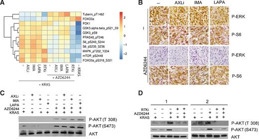 Figure 4. A, heatmap generated from RPPA analysis (mean values from three independent lines) of PI3K–AKT effector proteins from iKRAS cells cultured with doxycycline (KRASG12D expressed) and treated for 48 hours with one or all three RTK inhibitors (RTKi; 1 μmol/L AXLi, 1 μmol/L imatinib, or 1 μmol/L lapatinib) alone or in combination with 2 μmol/L AZD6244. B, representative IHC of phospho-ERK and phospho-S6 of tumors derived from iKRAS allografts treated with AXLi 30 mg/kg every day, imatinib 100 mg/kg every day, or lapatinib 100 mg/kg every day, or the combination of each RTK inhibitor with 100 mg/kg every day AZD6244. C, AKT phosphorylation levels on residues T308 and S473 in iKRAS cells cultured in doxycycline (KRASG12D expressed) and treated for 48 hours with a single RTK inhibitor (1 μmol/L AXLi, 1 μmol/L imatinib, or 1 μmol/L lapatinib) alone or in combination with 2 μmol/L AZD6244. D, AKT phosphorylation levels on residues T308 and S473 in iKRAS cells cultured in doxycycline and treated for 48 hours with three RTK inhibitors (RTKi; 1 μmol/L AXLi, 1 μmol/L imatinib, or 1 μmol/L lapatinib), alone or in combination with 2 μmol/L AZD6244. iKRAS cells were also analyzed 48 hours after doxycycline withdrawal (KRASG12D ablated).